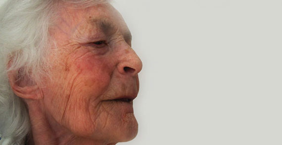 Vascular dementia: spotting the signs, addressing the causes Vascular dementia: spotting the signs, addressing the causes