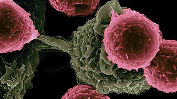 colorectal cancer gut bacteria