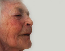 Some promising treatments for Alzheimer’s Some promising treatments for Alzheimer’s