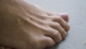 Sensors embedded in bandages could monitor diabetic foot wounds