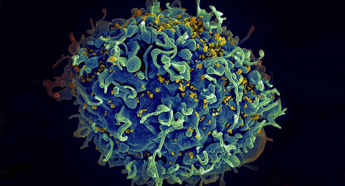 Study points to way to reducing many of the negative effects of HIV