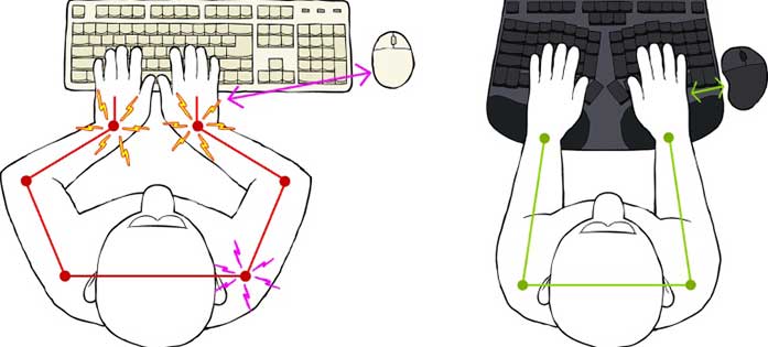 Cleave ergonomic keyboard